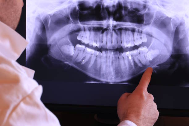 Best Broken Tooth Emergency  in Enterprise, UT